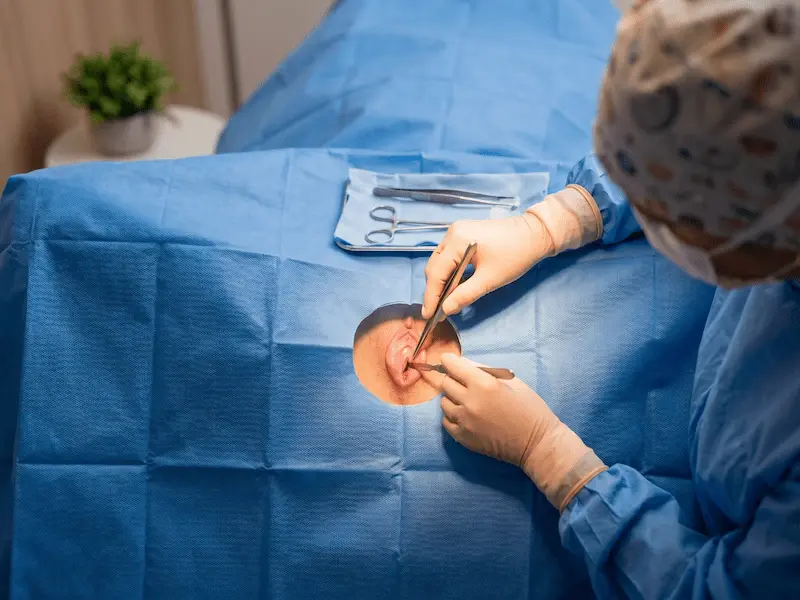 Intróito vaginal externo: abordagem cirúrgica e avaliação individualizada
